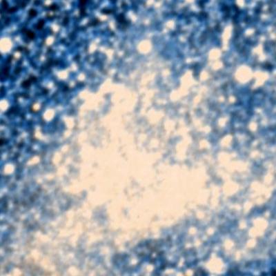NGC 1910 survey image